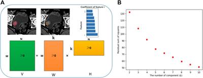 Radiomics of Contrast-Enhanced Computed Tomography: A Potential Biomarker for Pretreatment Prediction of the Response to Bacillus Calmette-Guerin Immunotherapy in Non-Muscle-Invasive Bladder Cancer